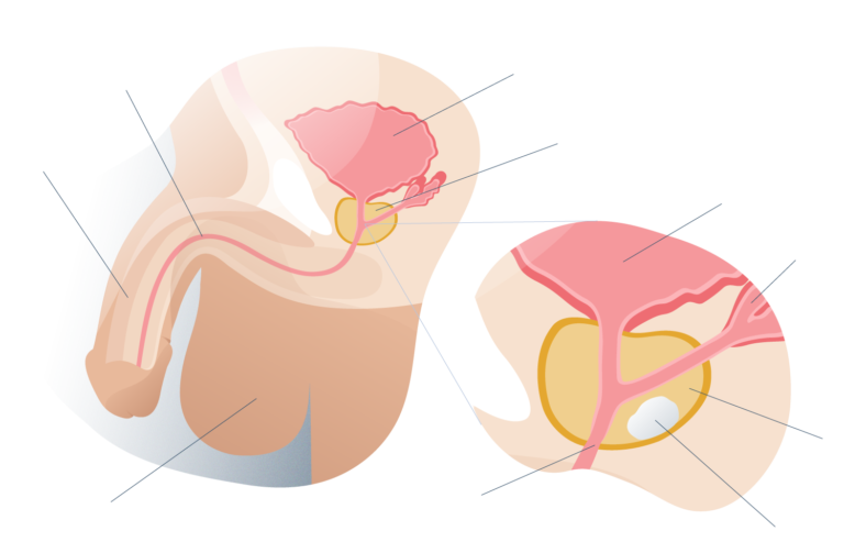 Anatomía de la próstata y cáncer