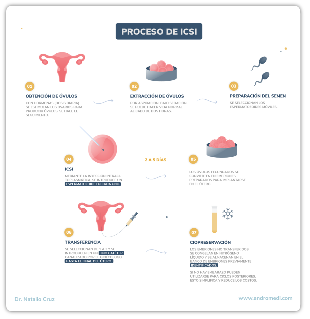 Infografia sobre el proceso de inyección intracitoplasmatica de esperma invitro