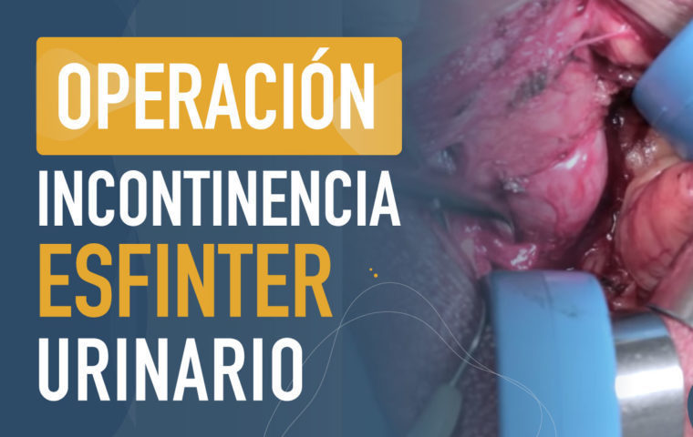 Operación del esfinter en la incontinencia urinaria
