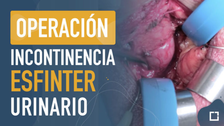 Operación del esfinter en la incontinencia urinaria