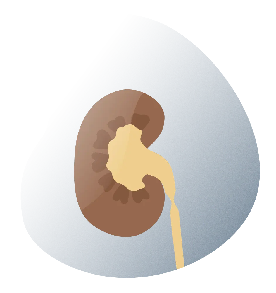 andromedi pieloplastia cirugia de reparacion 01 (1)