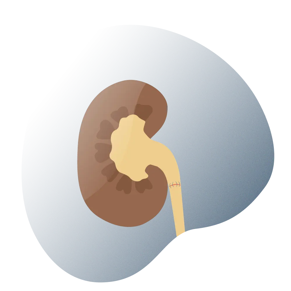 andromedi pieloplastia cirugia de reparacion 03 (1)