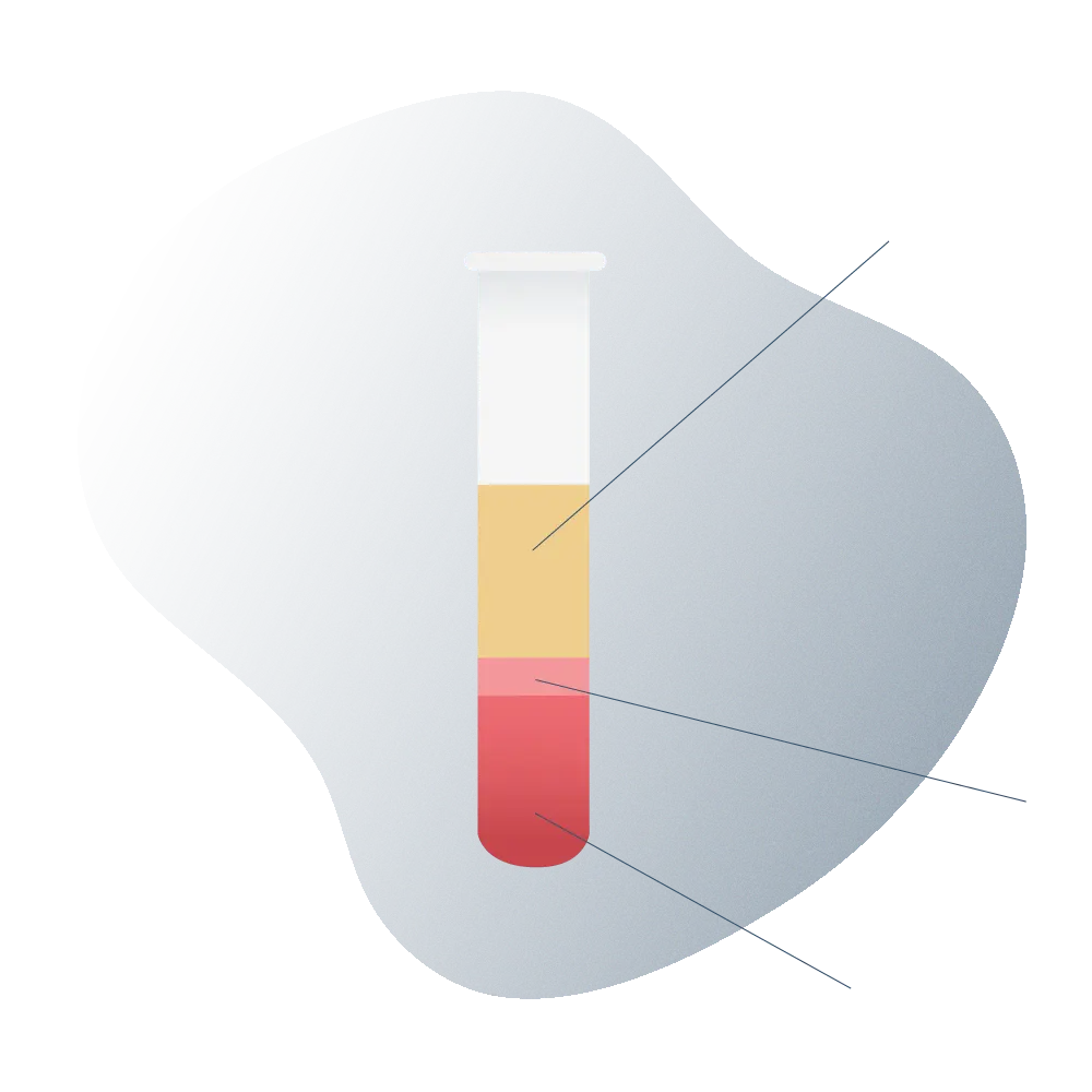 andromedi plasma rico en plaquetas para la impotencia 01 (1)