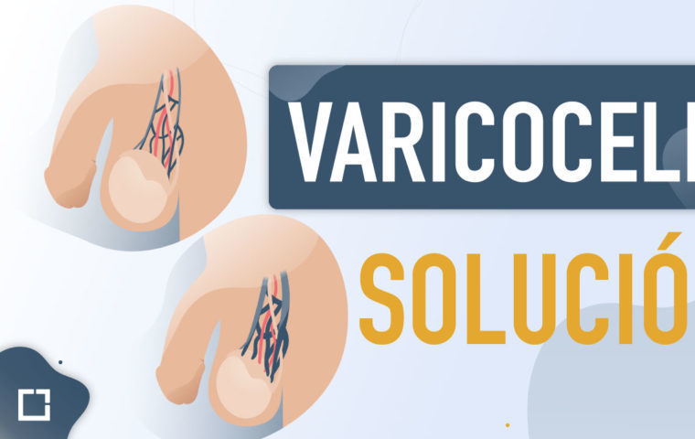 Solución al varicocele