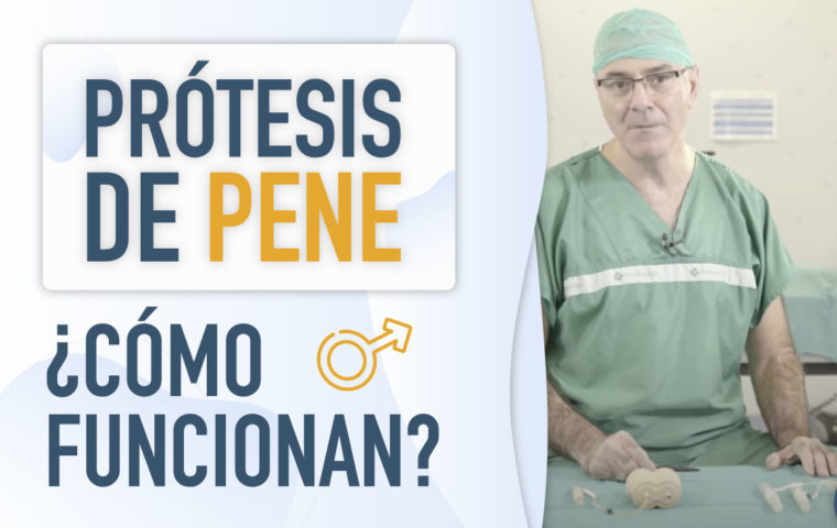 ¿Como funcionan las prótesis de pene?