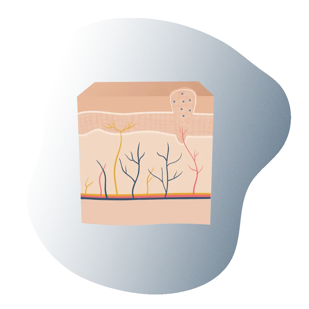 andromedi verruga por papiloma antes y despues 02 (1)