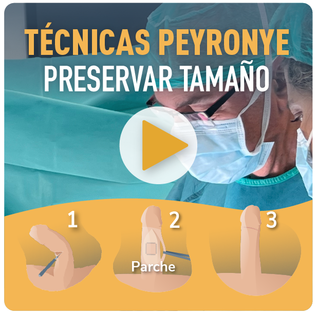 CirugíaS PEYRONIE Andromedi